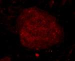 C19orf35 Antibody in Immunocytochemistry (ICC/IF)