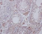 C19orf35 Antibody in Immunohistochemistry (Paraffin) (IHC (P))