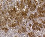 ALDH2 Antibody in Immunohistochemistry (Paraffin) (IHC (P))