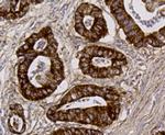 ALDH2 Antibody in Immunohistochemistry (Paraffin) (IHC (P))