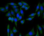 PI3K p85 alpha Antibody in Immunocytochemistry (ICC/IF)