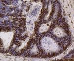 PI3K p85 alpha Antibody in Immunohistochemistry (Paraffin) (IHC (P))