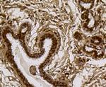 PI3K p85 alpha Antibody in Immunohistochemistry (Paraffin) (IHC (P))