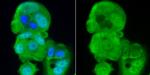 PP2A alpha/beta Antibody in Immunocytochemistry (ICC/IF)