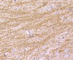 MAL Antibody in Immunohistochemistry (Paraffin) (IHC (P))