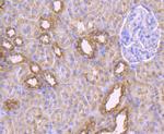 MAL Antibody in Immunohistochemistry (Paraffin) (IHC (P))