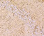 MAL Antibody in Immunohistochemistry (Paraffin) (IHC (P))