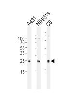 RAC1 Antibody in Western Blot (WB)