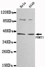 PRMT1 Antibody in Western Blot (WB)