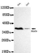 PRMT6 Antibody in Western Blot (WB)