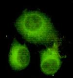 ATP Citrate Lyase Antibody in Immunocytochemistry (ICC/IF)