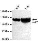 ATP Citrate Lyase Antibody in Western Blot (WB)