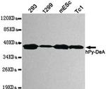 PDHA1 Antibody in Western Blot (WB)