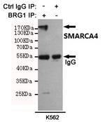 BRG1 Antibody in Immunoprecipitation (IP)