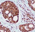 RAD23B Antibody in Immunohistochemistry (Paraffin) (IHC (P))