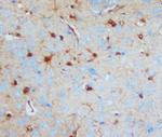 S100B Antibody in Immunohistochemistry (Paraffin) (IHC (P))