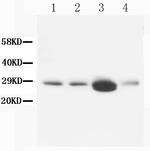 Calbindin D28K Antibody in Western Blot (WB)