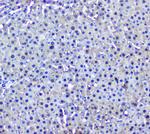 GSTM1 Antibody in Immunohistochemistry (Paraffin) (IHC (P))