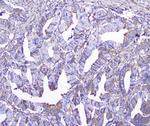 GSTM1 Antibody in Immunohistochemistry (Paraffin) (IHC (P))