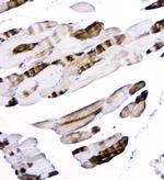 alpha Actinin 3 Antibody in Immunohistochemistry (Paraffin) (IHC (P))