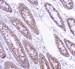 CD2AP Antibody in Immunohistochemistry (Paraffin) (IHC (P))