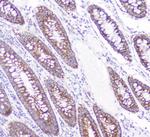 CD2AP Antibody in Immunohistochemistry (Paraffin) (IHC (P))