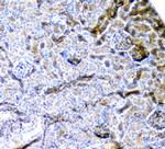 CD2AP Antibody in Immunohistochemistry (Paraffin) (IHC (P))