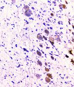 CD2AP Antibody in Immunohistochemistry (Paraffin) (IHC (P))