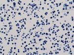 6x-His Tag Antibody in Immunocytochemistry (ICC/IF)