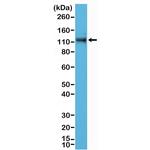 delta Catenin Antibody in Western Blot (WB)