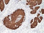 Cytokeratin 14 Antibody in Immunohistochemistry (Paraffin) (IHC (P))