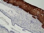 Cytokeratin 14 Antibody in Immunohistochemistry (Paraffin) (IHC (P))