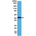 Cytokeratin 14 Antibody in Western Blot (WB)