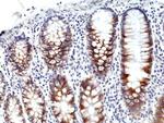 CD71 (Transferrin Receptor) Antibody in Immunohistochemistry (Paraffin) (IHC (P))