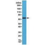 Placental Alkaline Phosphatase Antibody in Western Blot (WB)