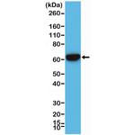 Cytokeratin 5/6 Antibody in Western Blot (WB)