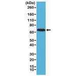 NEFL Antibody in Western Blot (WB)