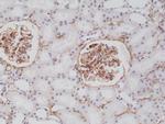 PDGFRB Antibody in Immunohistochemistry (Paraffin) (IHC (P))