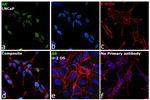 Androgen Receptor Antibody in Immunocytochemistry (ICC/IF)