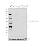 Androgen Receptor Antibody in Western Blot (WB)