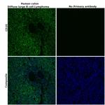 CD20 Antibody in Immunohistochemistry (Paraffin) (IHC (P))