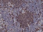 CD20 Antibody in Immunohistochemistry (Paraffin) (IHC (P))