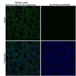 CD20 Antibody in Immunohistochemistry (Paraffin) (IHC (P))