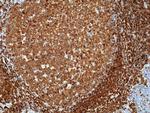 CD79a Antibody in Immunohistochemistry (Paraffin) (IHC (P))