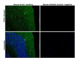 CD56 (NCAM) Antibody in Immunohistochemistry (Paraffin) (IHC (P))