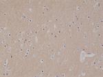 CD56 (NCAM) Antibody in Immunohistochemistry (Paraffin) (IHC (P))