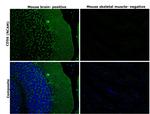 CD56 (NCAM) Antibody in Immunohistochemistry (Paraffin) (IHC (P))