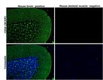 CD56 (NCAM) Antibody in Immunohistochemistry (Paraffin) (IHC (P))