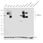 CD56 (NCAM) Antibody in Western Blot (WB)