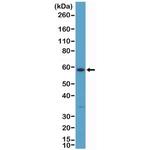 Cytokeratin 10 Antibody in Western Blot (WB)